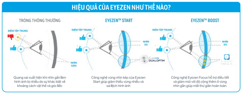 Phòng khám mắt, mắt kính Ths Bs Lữ Bảo Minh Bến Tre hieu qua cua eyezen