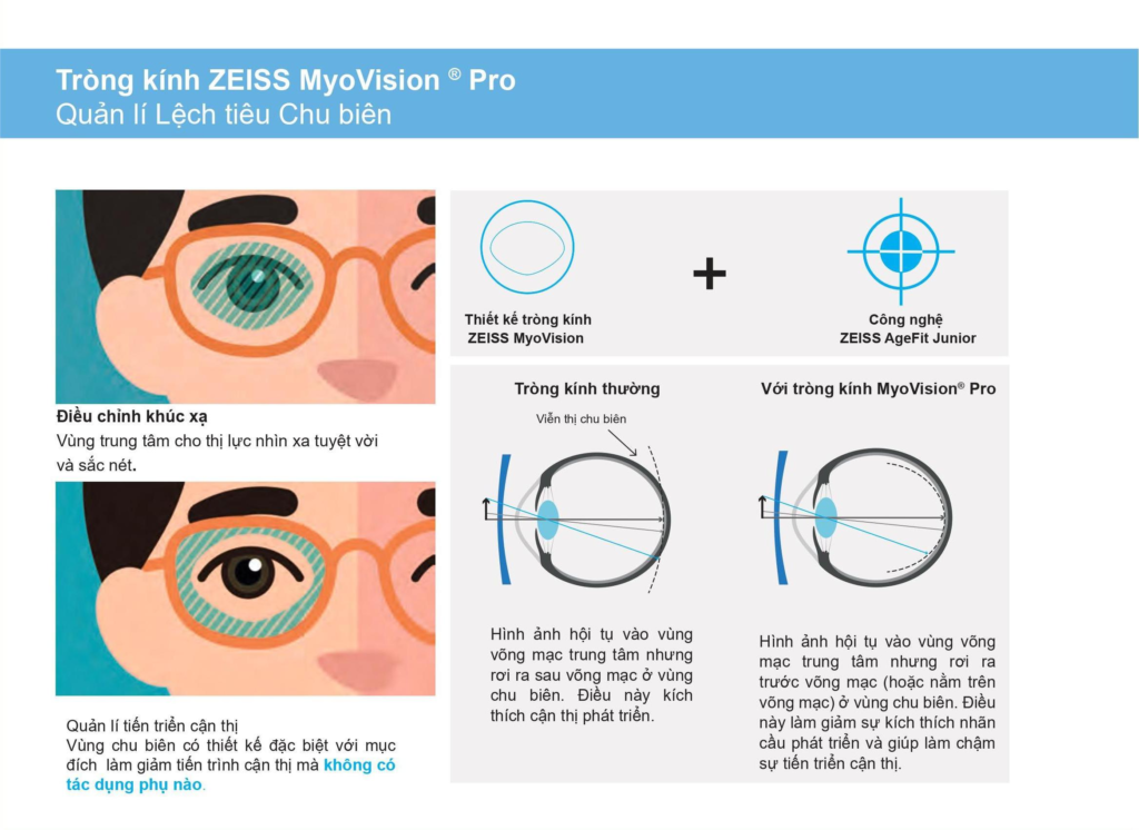 ZEISS MyoVision Pro tròng kính hạn chế tăng độ