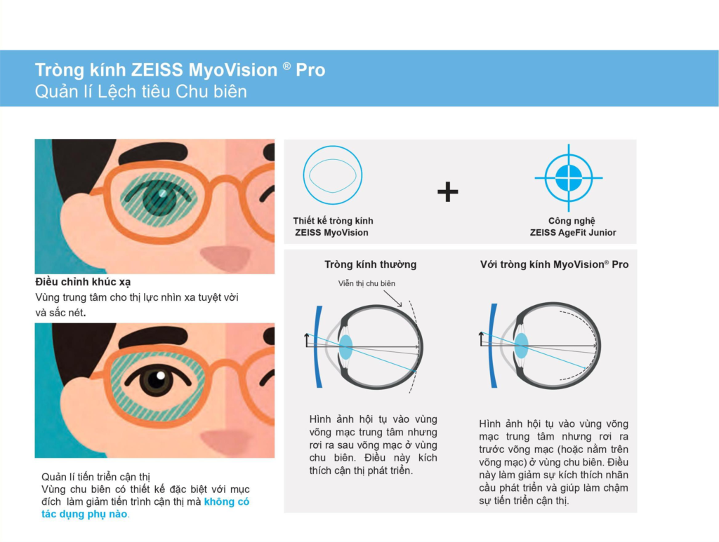 ZEISS MyoVision Pro