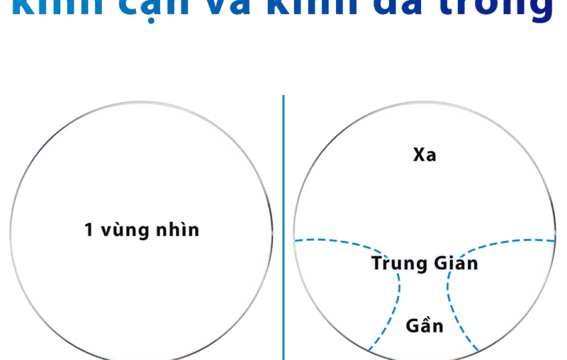 Sự khác biệt giữa kính cận và kính đa tròng 2024