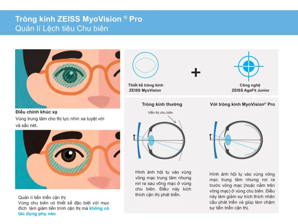 tròng kính kiểm soát cận thị trẻ em Zeiss MyoVision Pro tại Bến Tre
