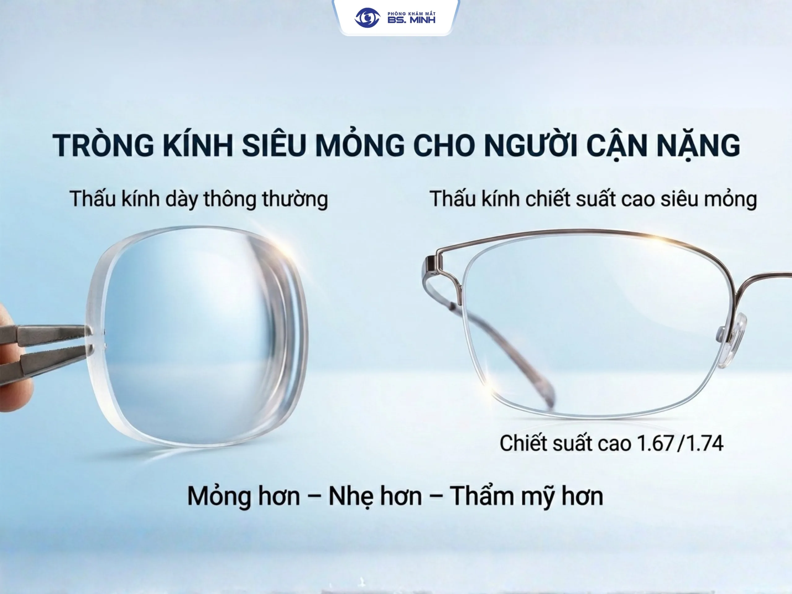 Tròng kính siêu mỏng cho người cận cao tại Bến Tre
