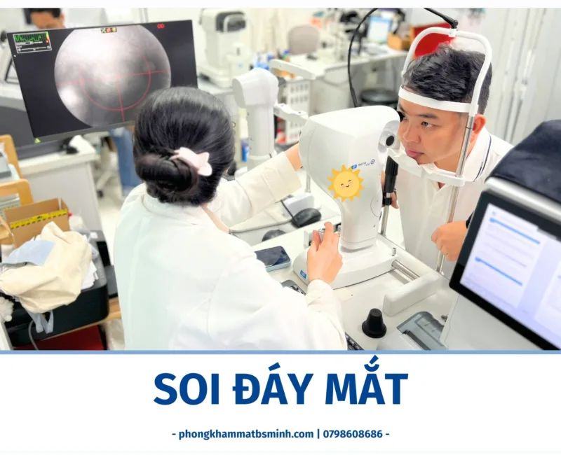 Soi đáy mắt