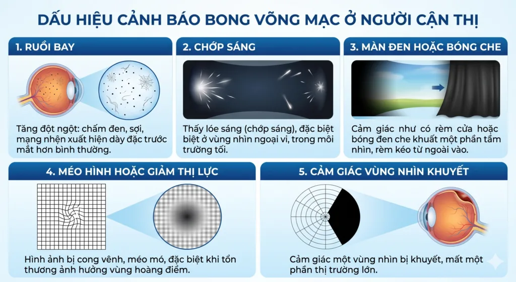 Cận thị và bong võng mạc - dấu hiệu ruồi bay chớp sáng màn che thị giác