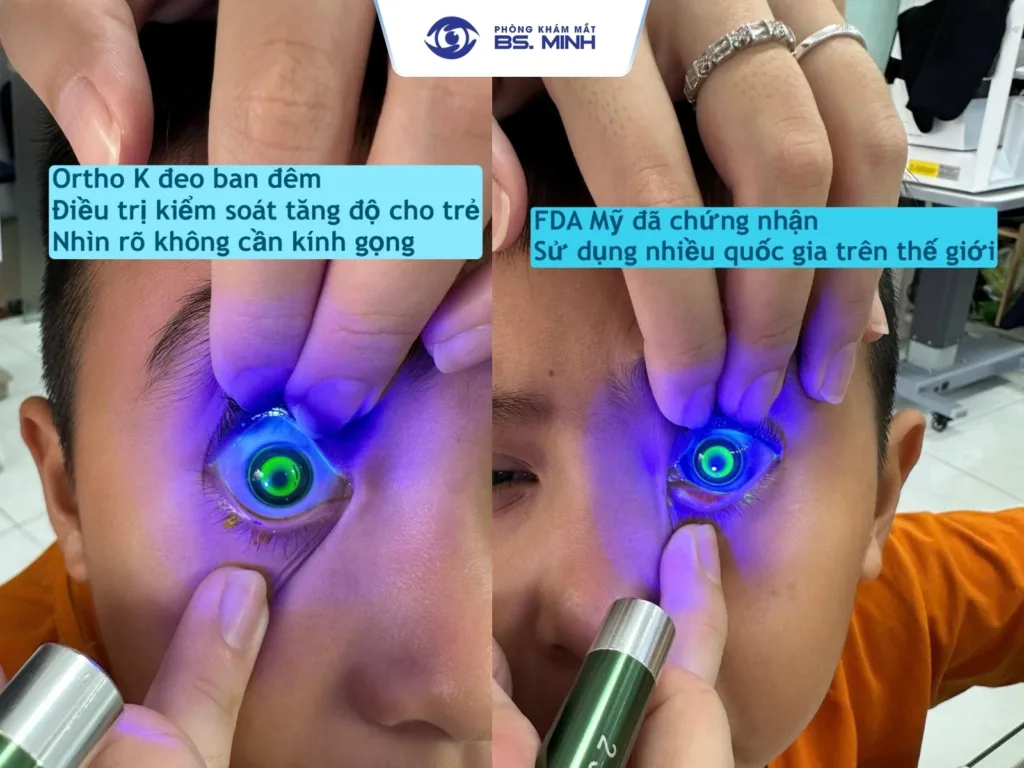 tre can thi tang do nhanh