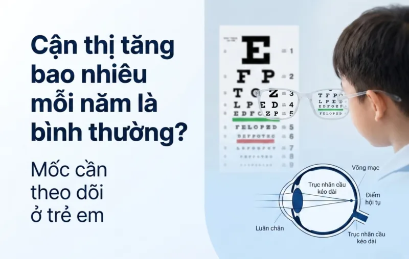 cận thị tăng bao nhiêu mỗi năm là bình thường
