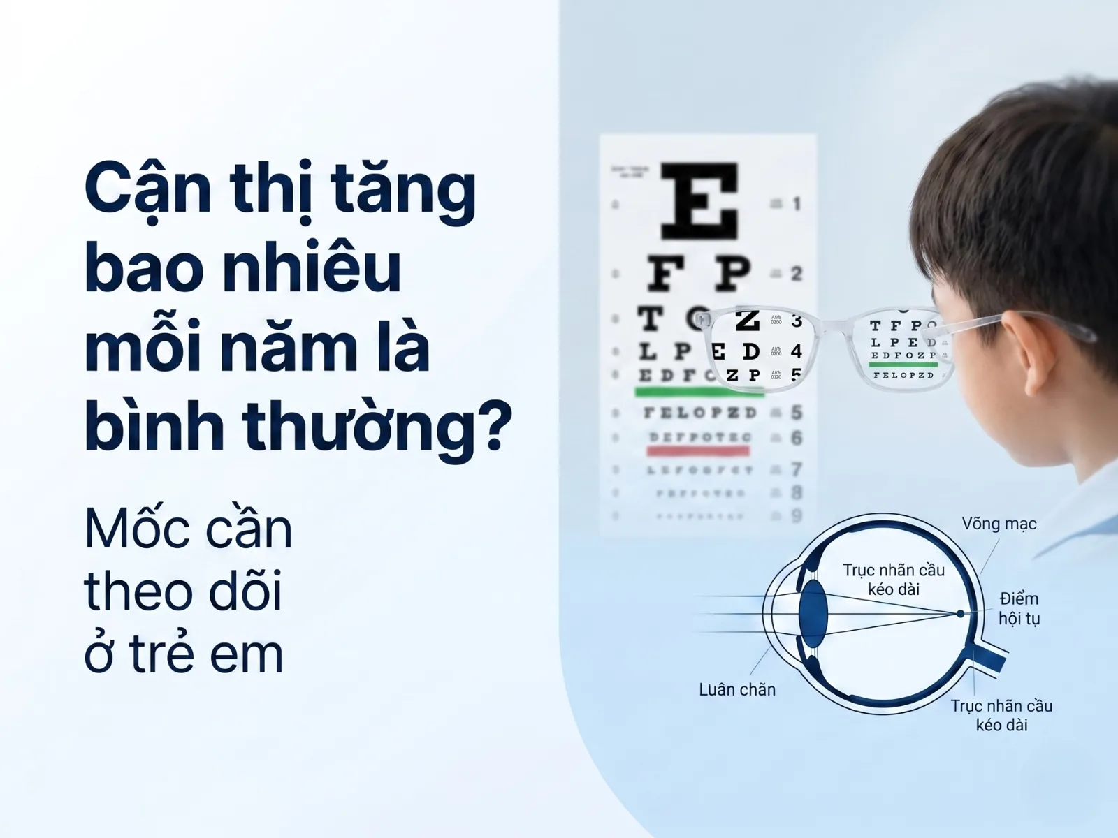 cận thị tăng bao nhiêu mỗi năm là bình thường