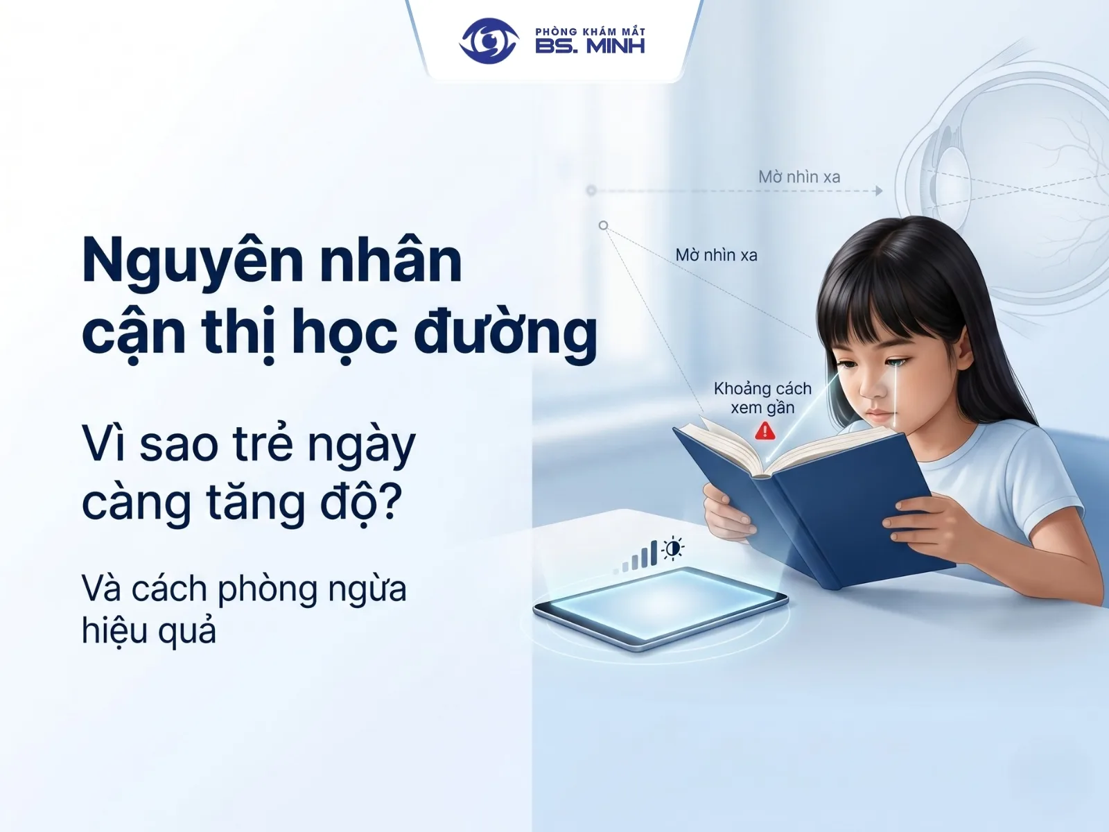 nguyen nhan can thi hoc duong