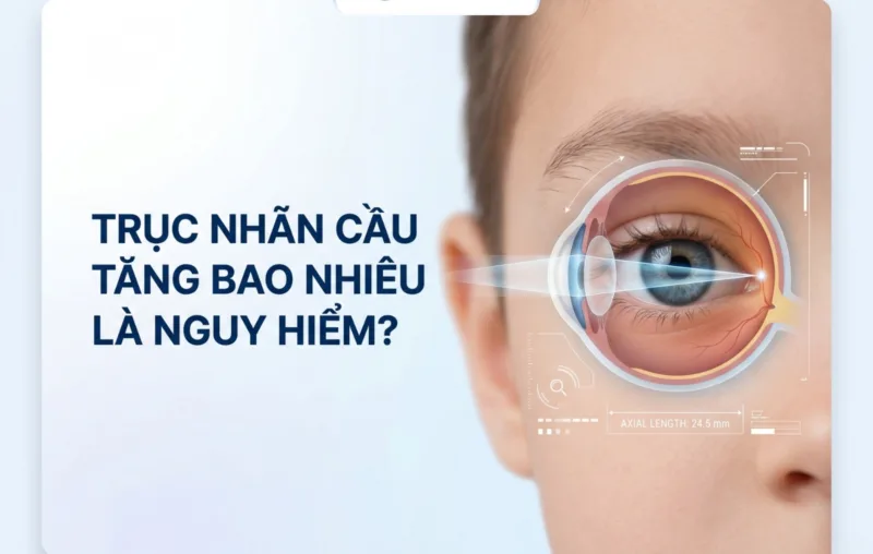truc nhan cau tang bao nhieu la nguy hiem