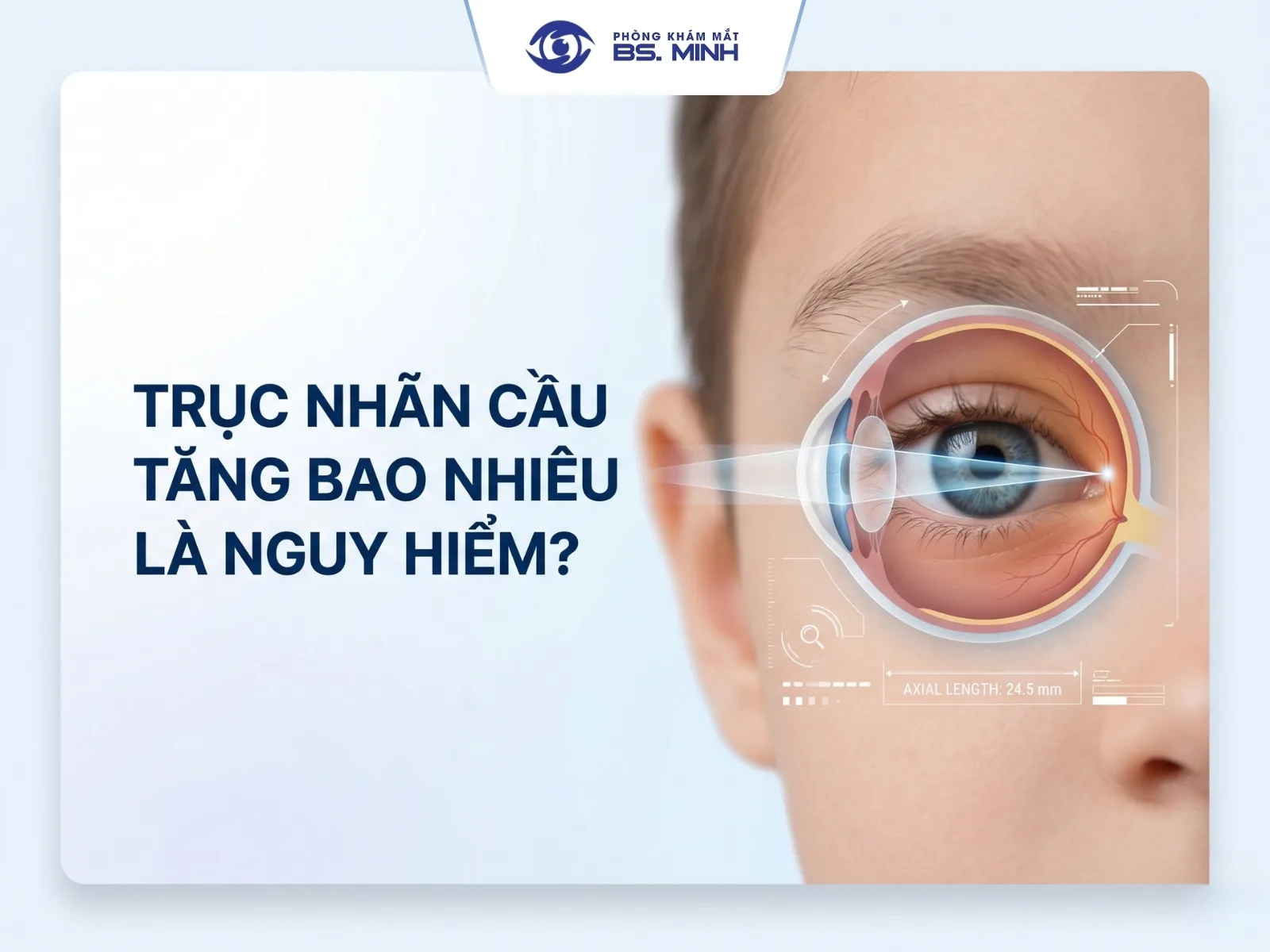 truc nhan cau tang bao nhieu la nguy hiem