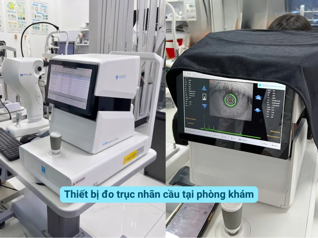 truc nhan cau tang bao nhieu la nguy hiem