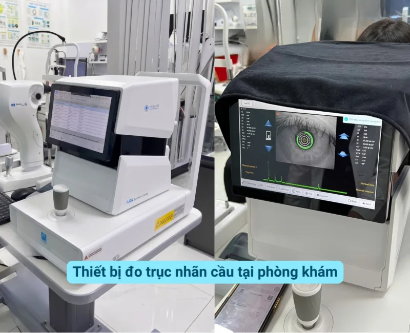 truc nhan cau tang bao nhieu la nguy hiem