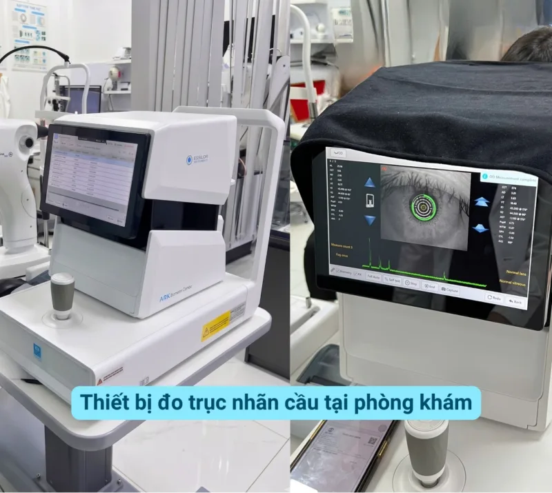 truc nhan cau tang bao nhieu la nguy hiem