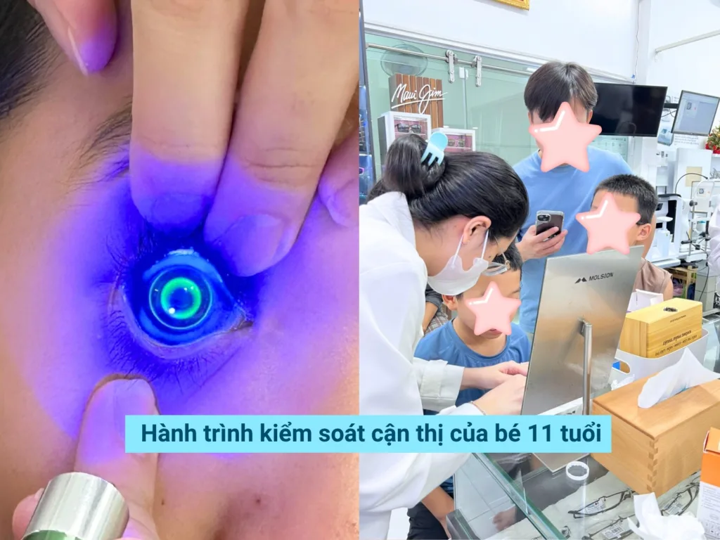 cach kiem soat can thi tre em