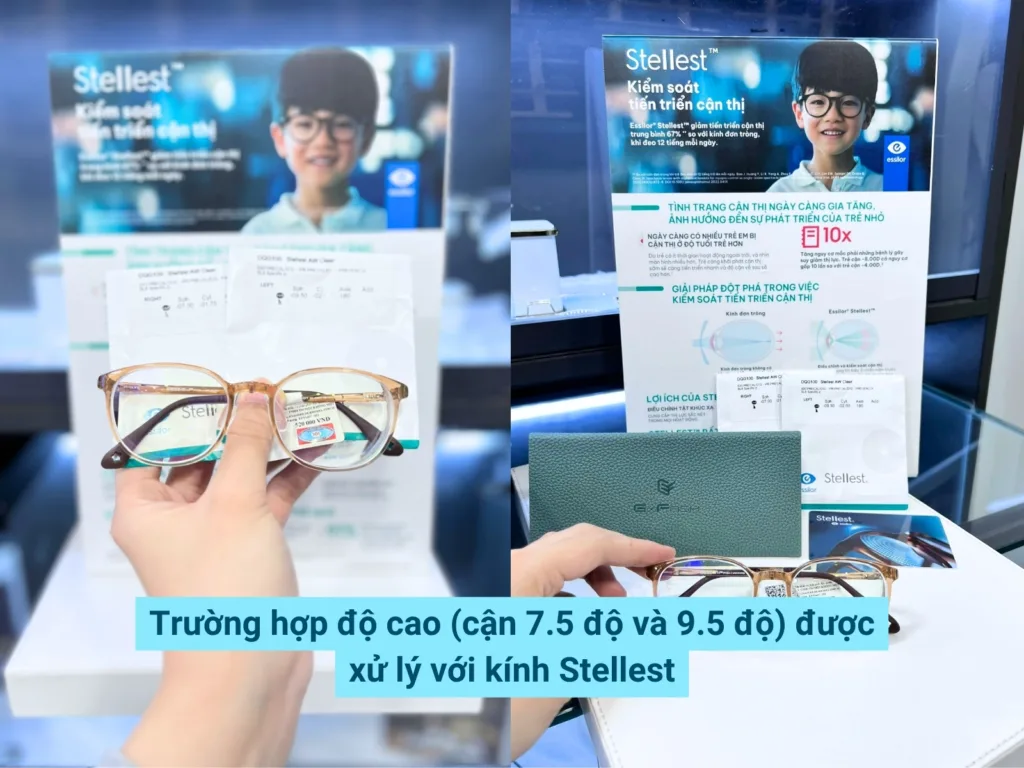 cach kiem soat can thi tre em