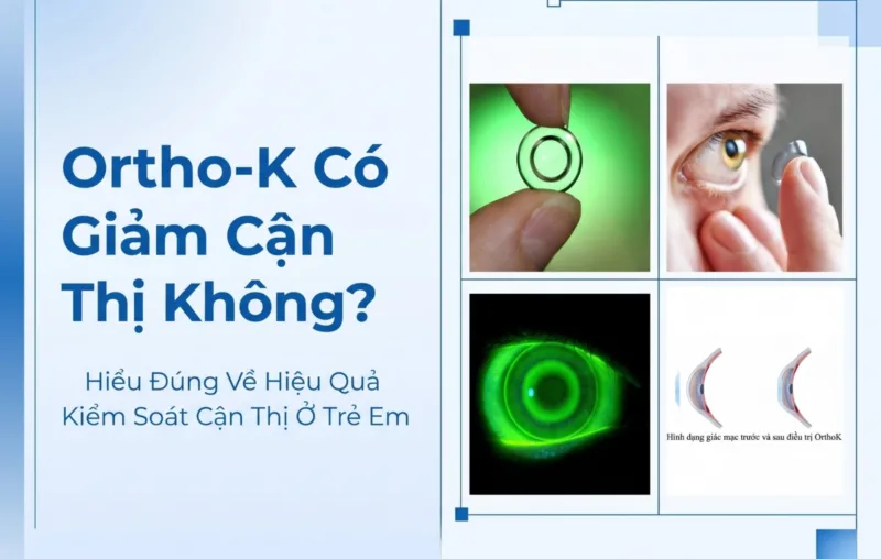 ortho-k co giam can thi khong