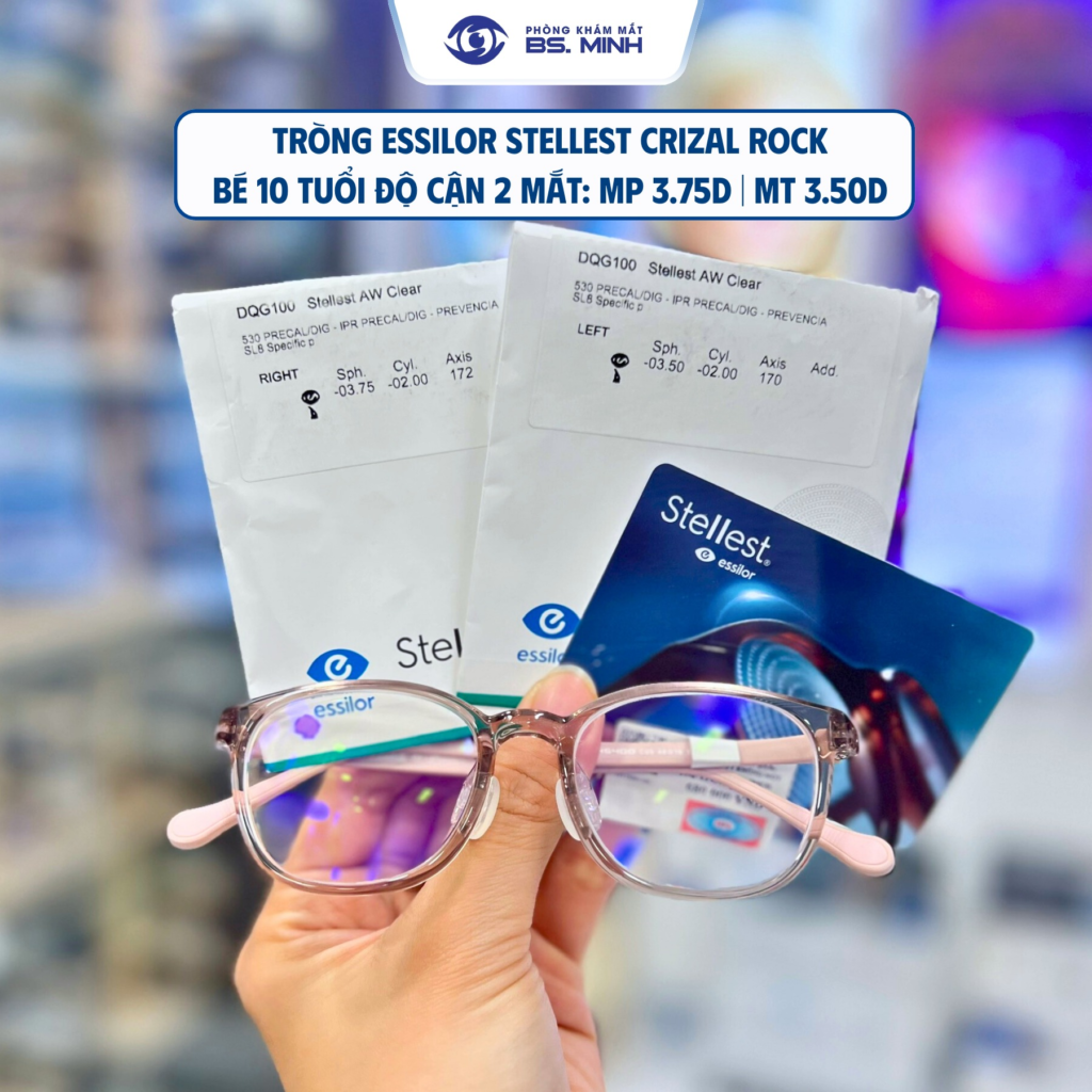 Kính kiểm soát cận thị Stellest cho trẻ em tại phòng khám