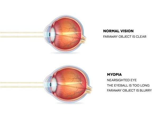 Phòng khám mắt, mắt kính Ths Bs Lữ Bảo Minh Bến Tre