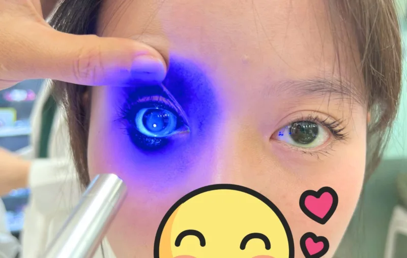 Giá Ortho-K tại Bến Tre