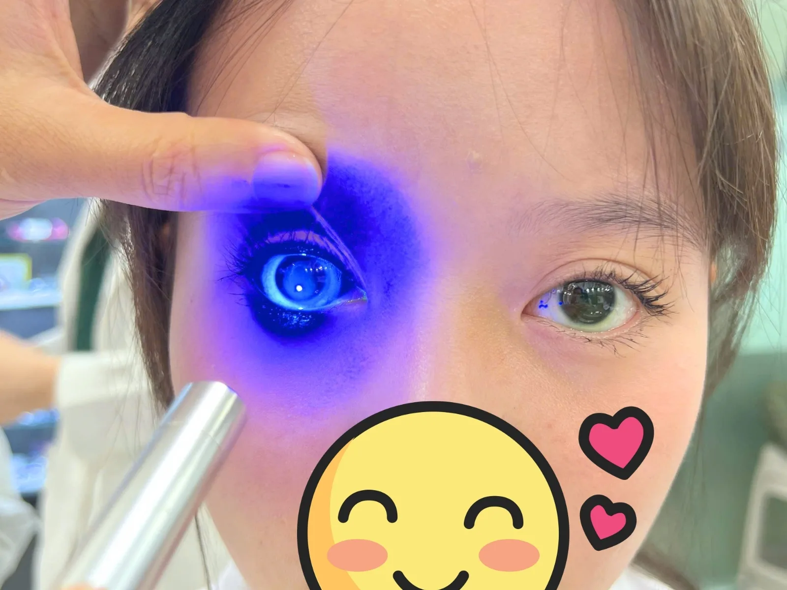 Giá Ortho-K tại Bến Tre
