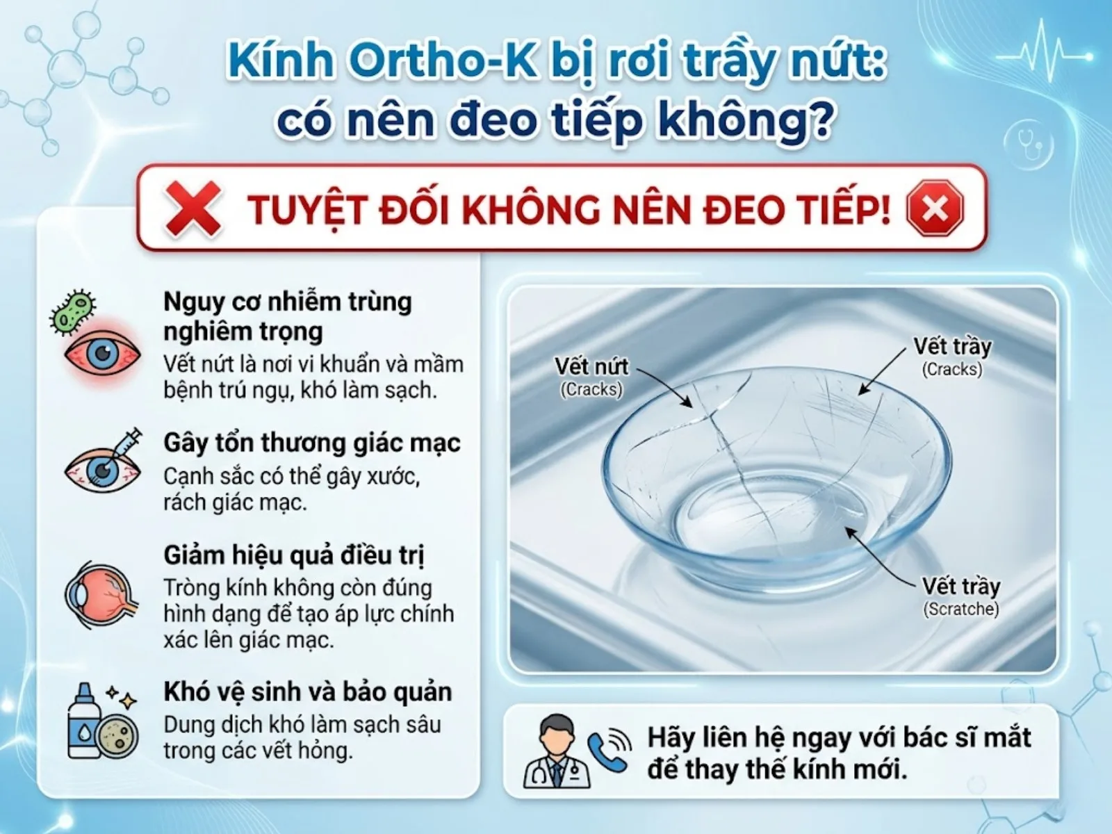 Kính Ortho-K bị rơi trầy nứt: có nên đeo tiếp không?