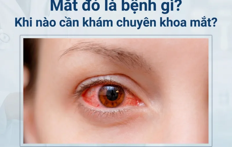 mat do la benh gi