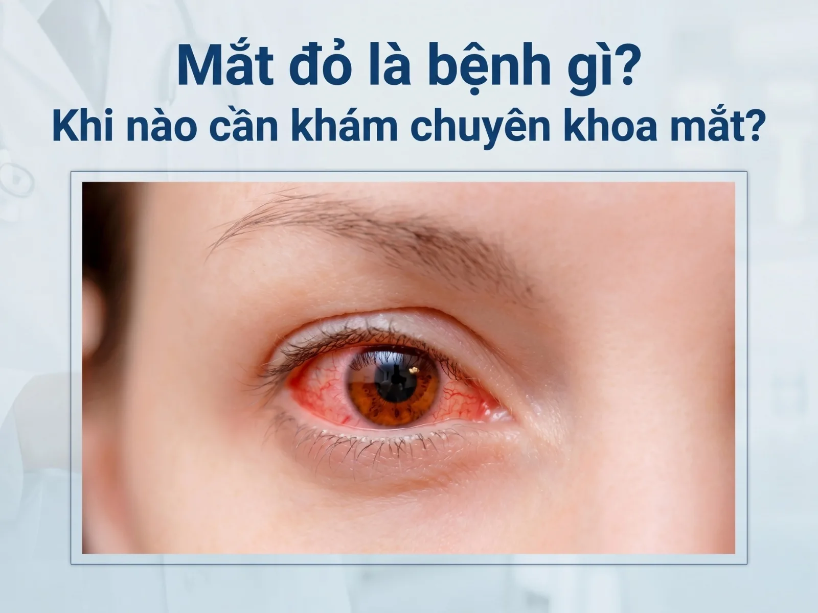 mat do la benh gi