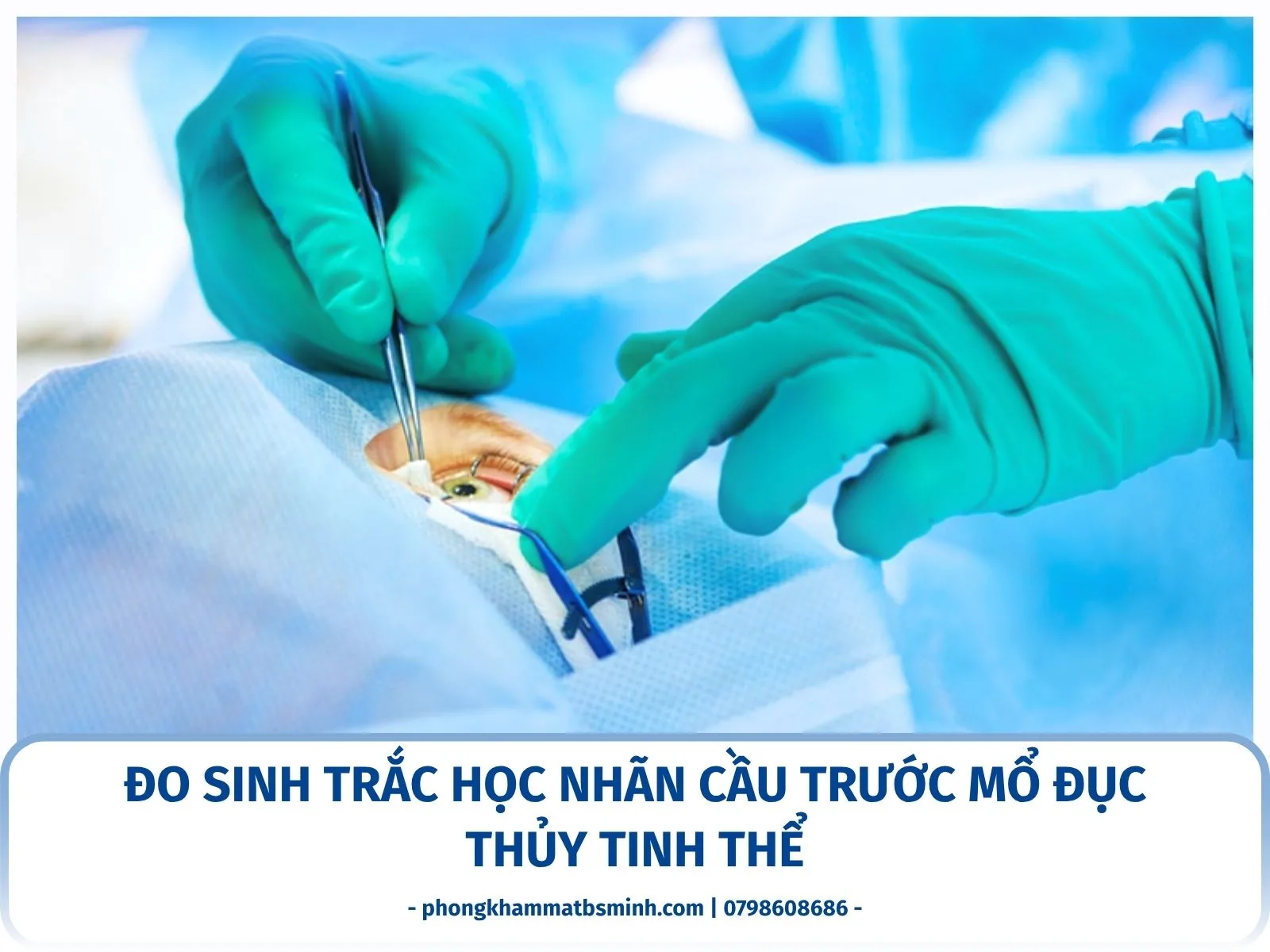 Đo sinh trắc học nhãn cầu trước mổ đục thủy tinh thể