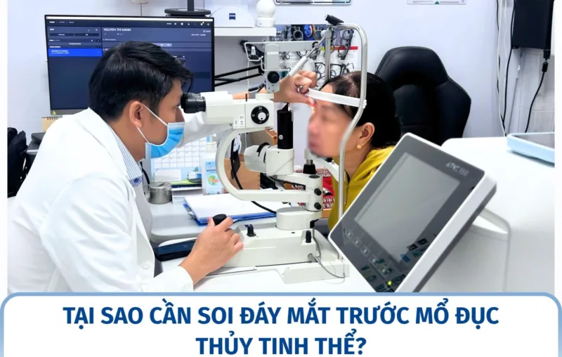 Tại sao cần soi đáy mắt trước mổ đục thủy tinh thể?