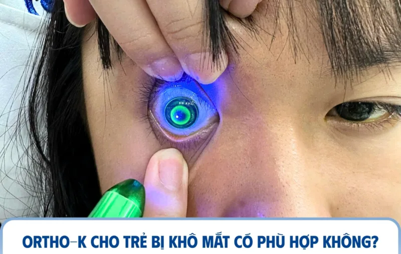 Ortho-K cho trẻ bị khô mắt có phù hợp không?