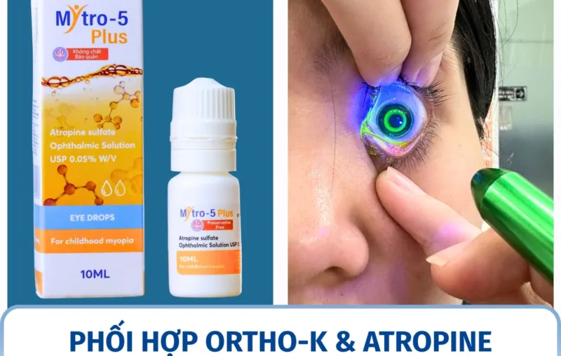 Phối hợp Ortho-K và Atropine: khi nào cân nhắc?