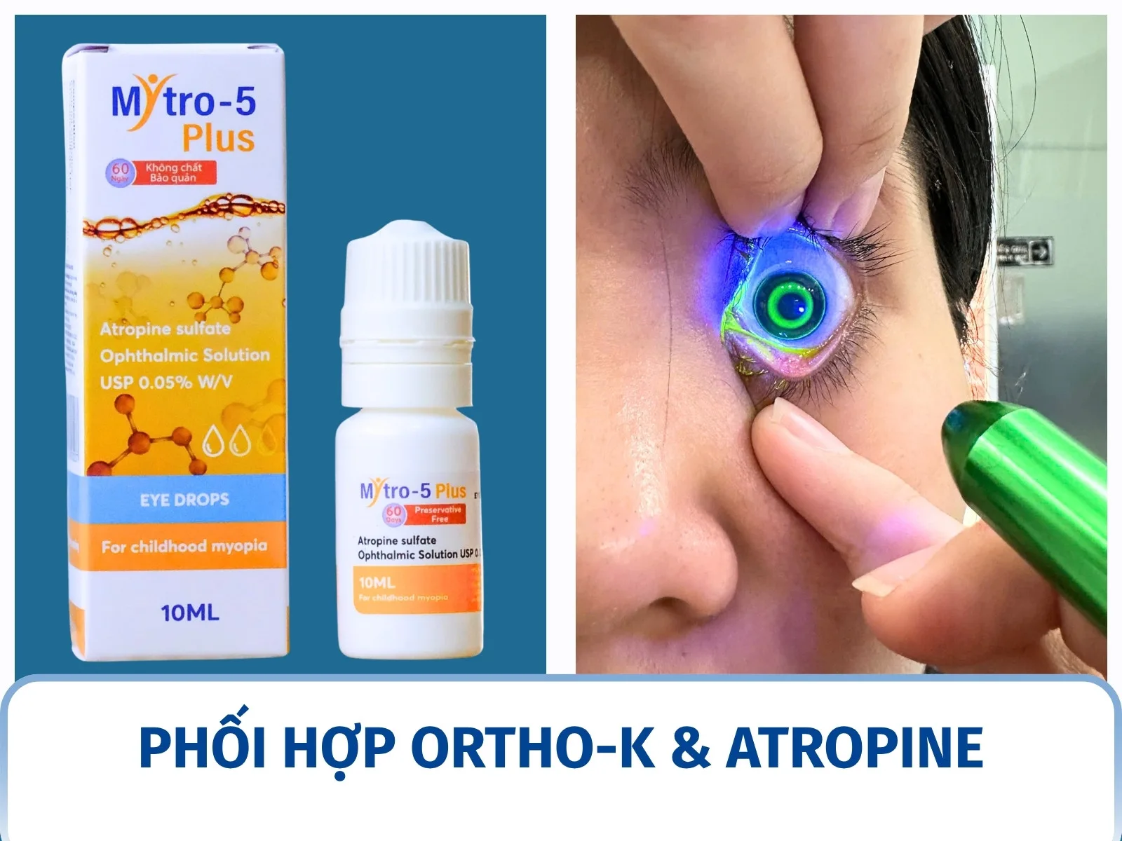 Phối hợp Ortho-K và Atropine: khi nào cân nhắc?
