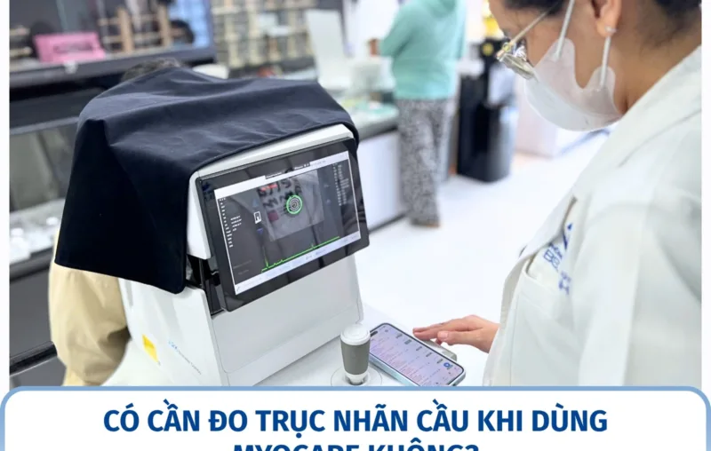 Có cần đo trục nhãn cầu khi dùng MyoCare không?