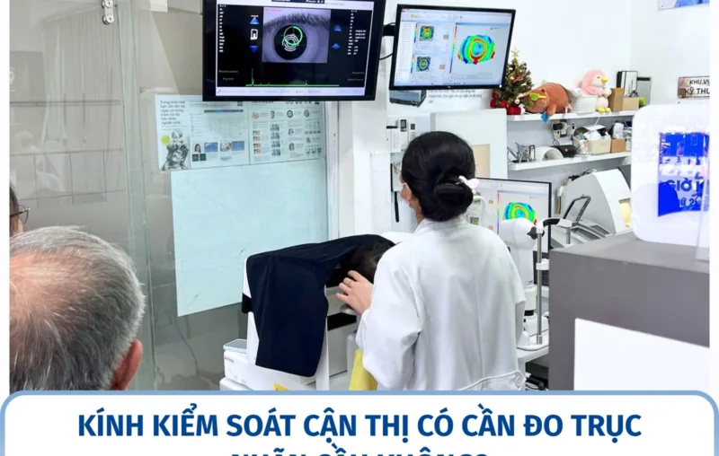 Kính kiểm soát cận thị có cần đo trục nhãn cầu không?