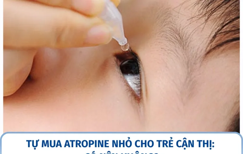 Tự mua Atropine nhỏ cho trẻ cận thị: có nên không?