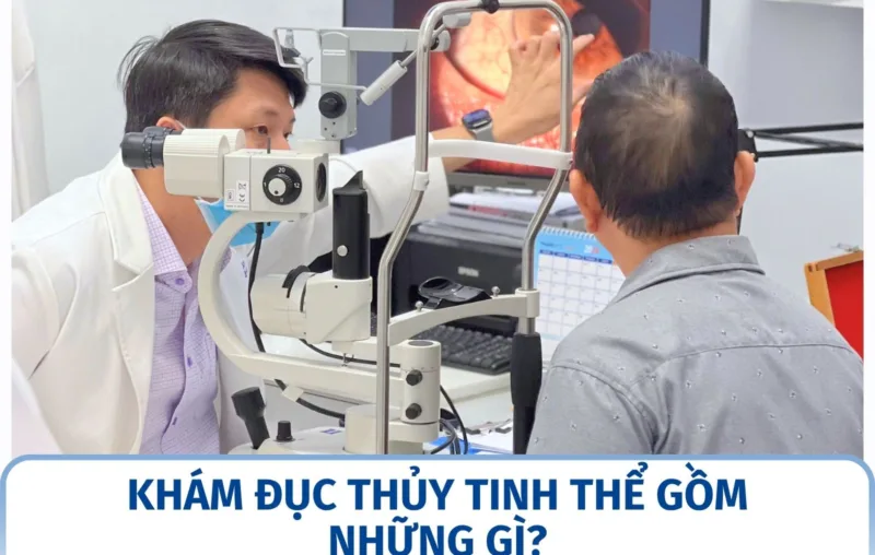 Khám đục thủy tinh thể gồm những gì?