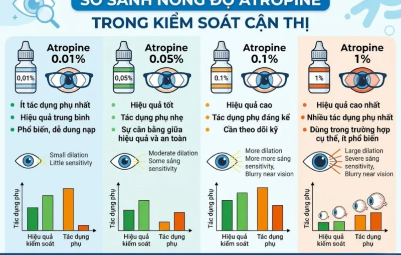 So sánh nồng độ Atropine trong kiểm soát cận thị