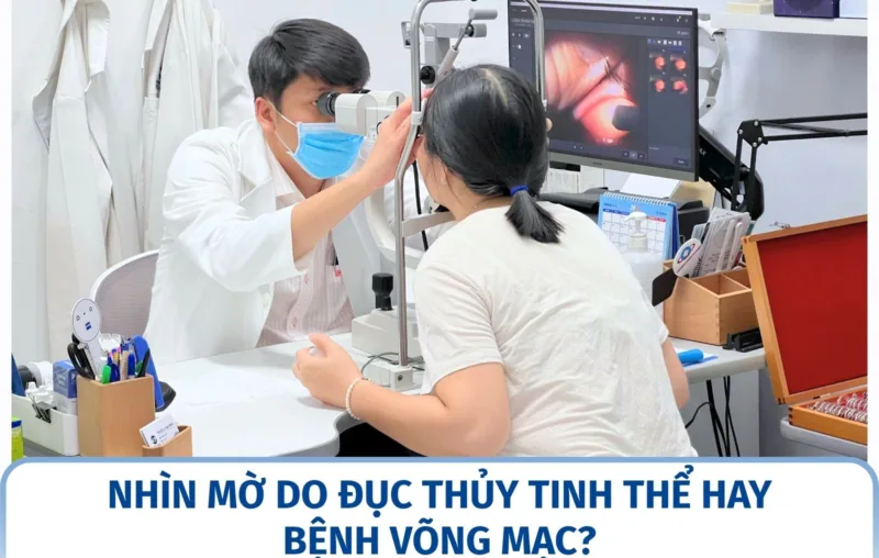 Nhìn mờ do đục thủy tinh thể hay bệnh võng mạc?