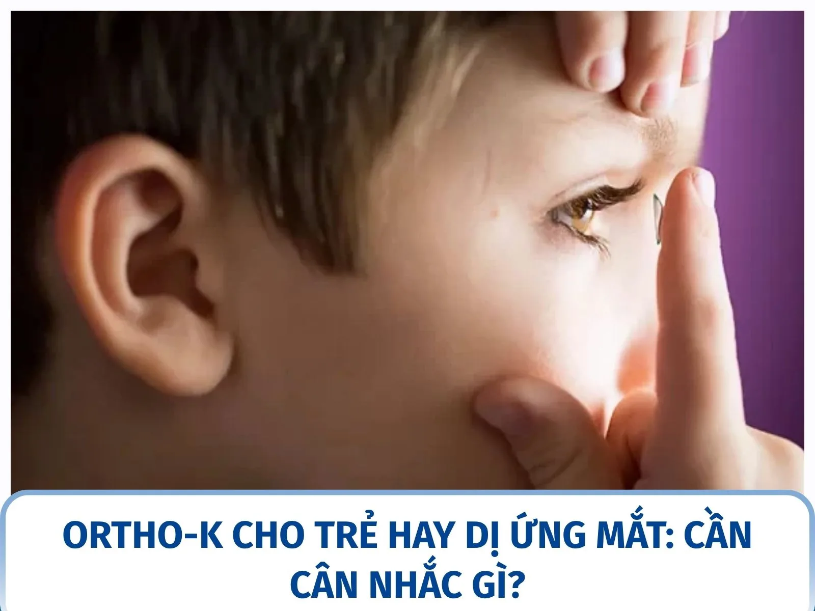 Ortho-K cho trẻ hay dị ứng mắt: cần cân nhắc gì?