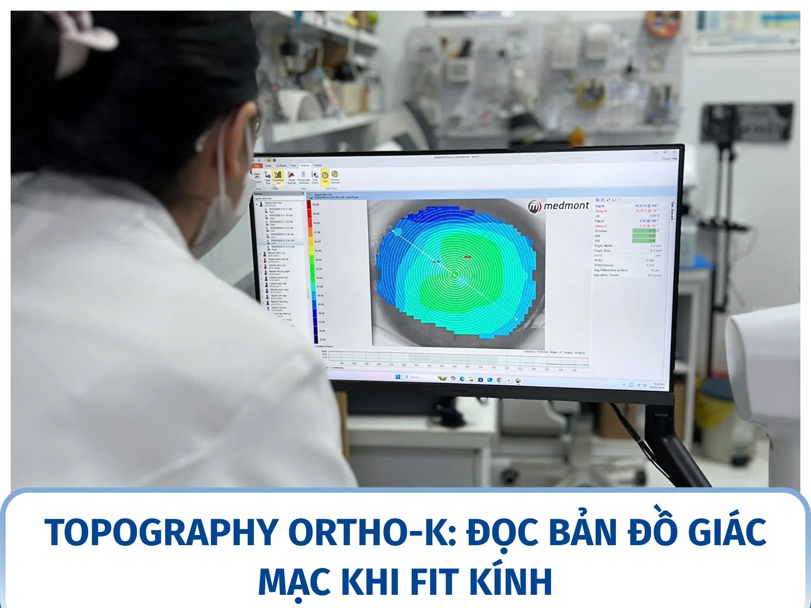 Topography Ortho-K: đọc bản đồ giác mạc khi fit kính