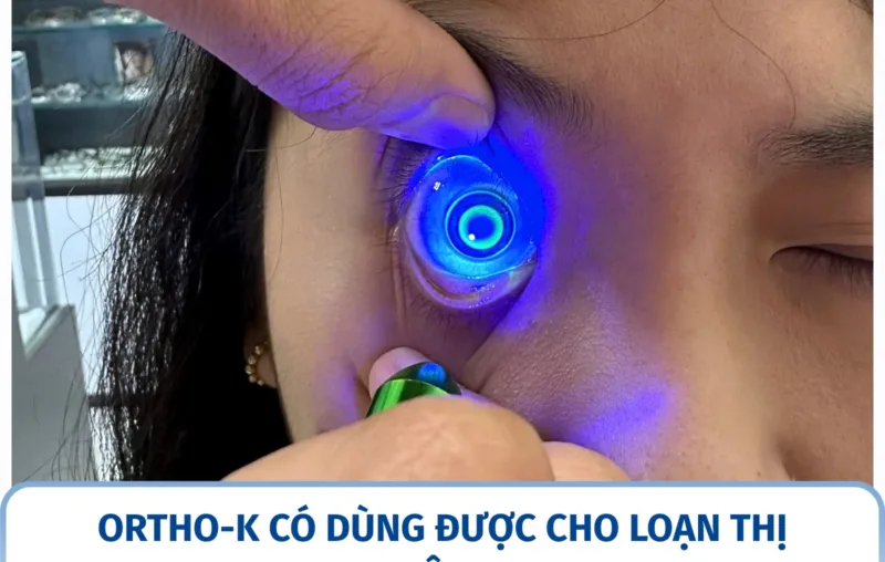 Ortho-K có dùng được cho loạn thị không?