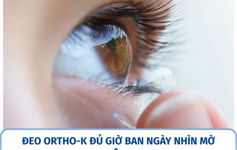 Đeo Ortho-K không đủ giờ thì ban ngày nhìn có mờ không