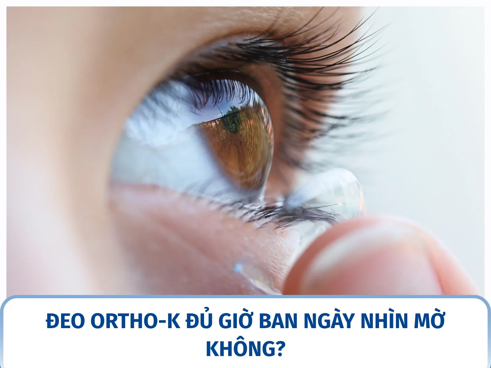 Đeo Ortho-K không đủ giờ thì ban ngày nhìn có mờ không