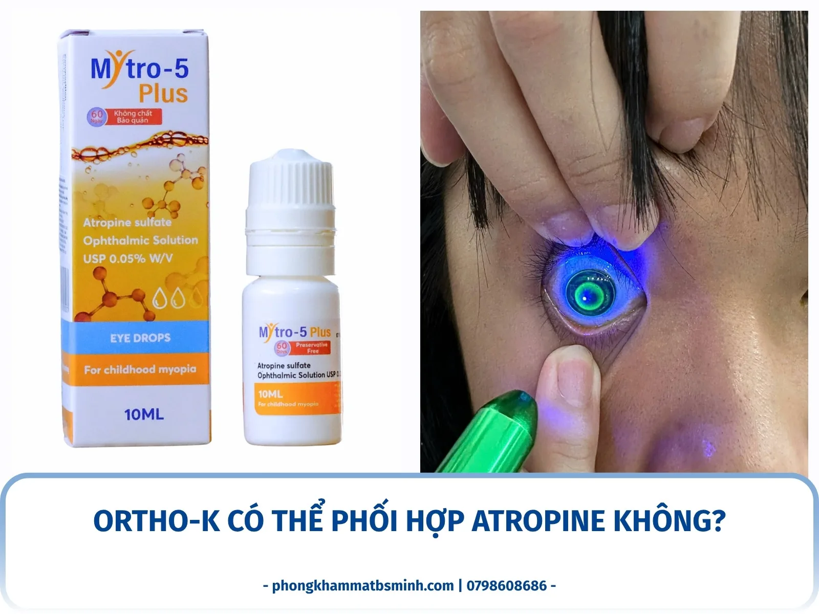Ortho-K có thể phối hợp Atropine không?