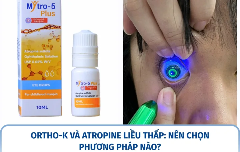 Ortho-K và Atropine liều thấp: nên chọn phương pháp nào?
