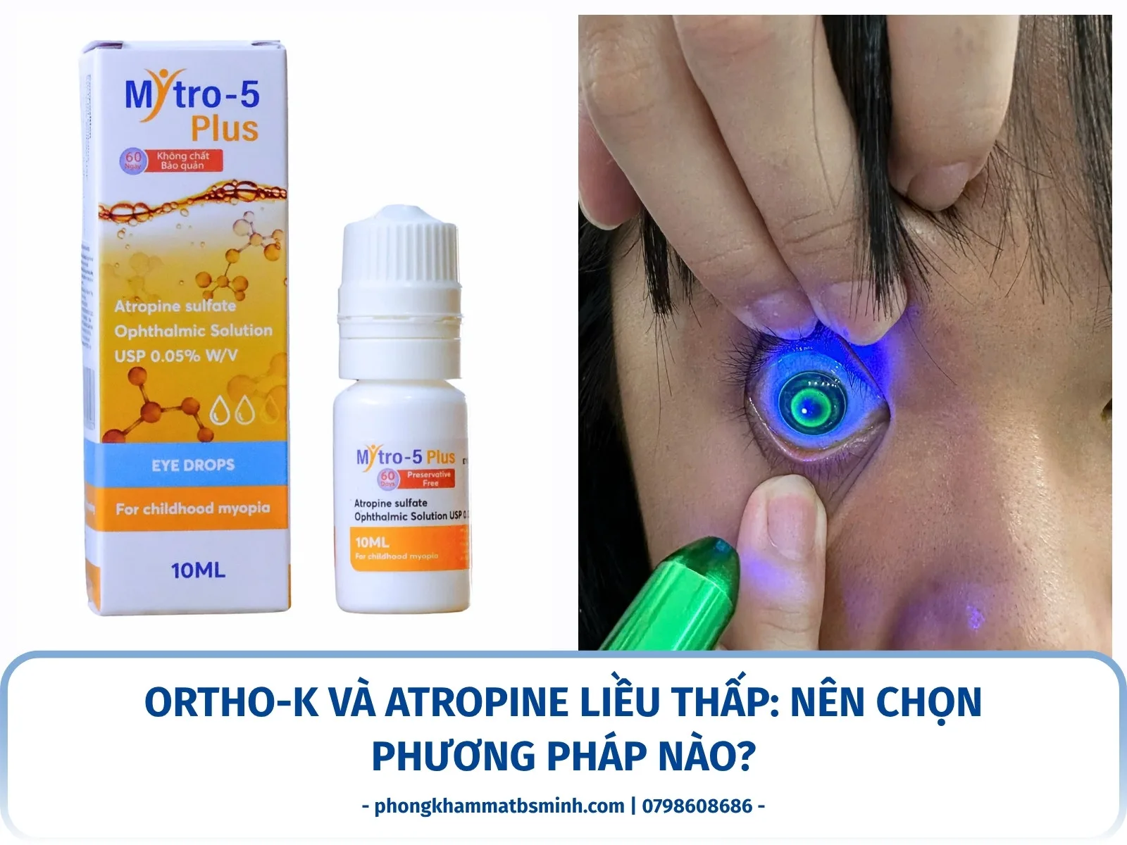 Ortho-K và Atropine liều thấp: nên chọn phương pháp nào?