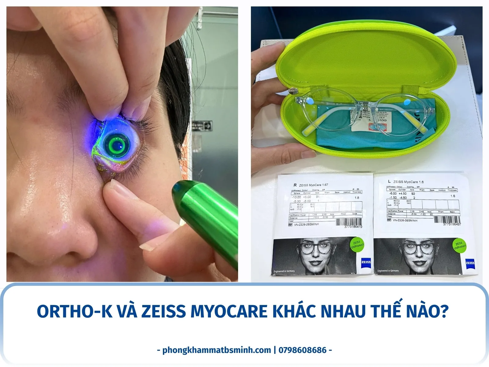 Ortho-K và ZEISS MyoCare khác nhau thế nào?