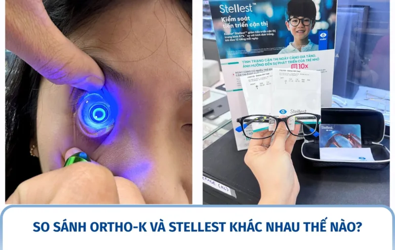So sánh Ortho-K và Stellest khác nhau thế nào?