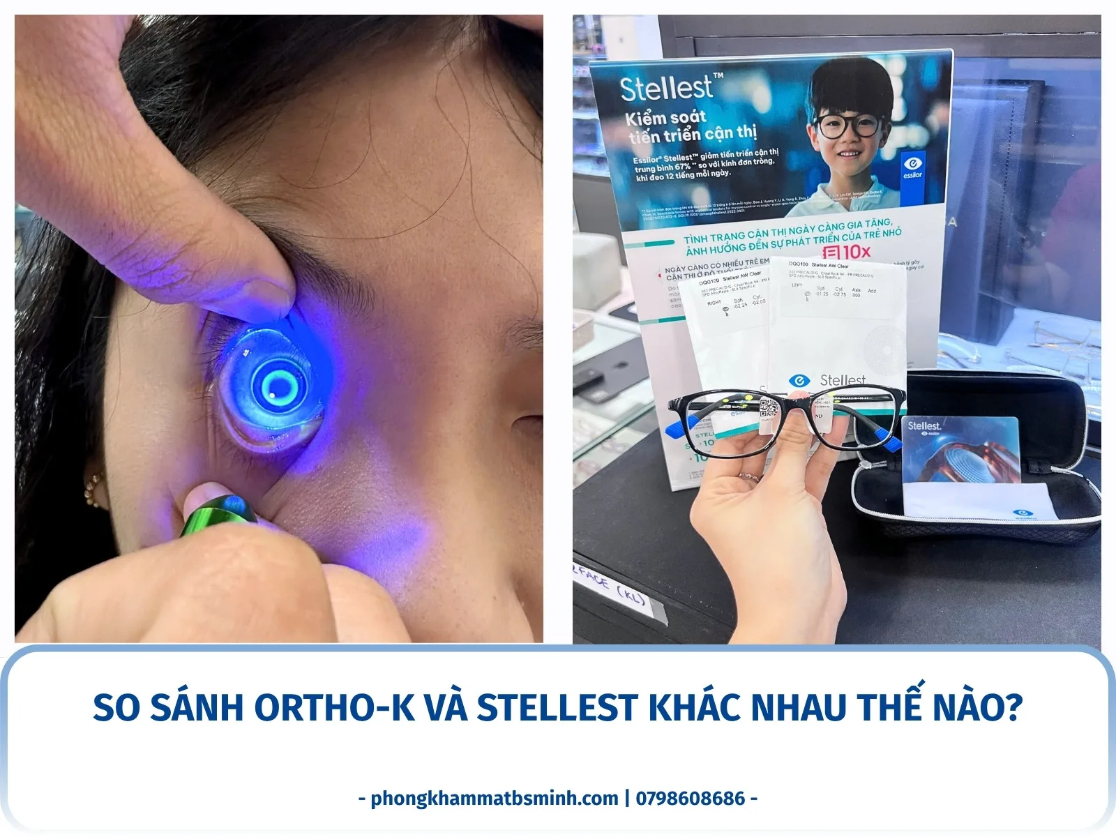 So sánh Ortho-K và Stellest khác nhau thế nào?