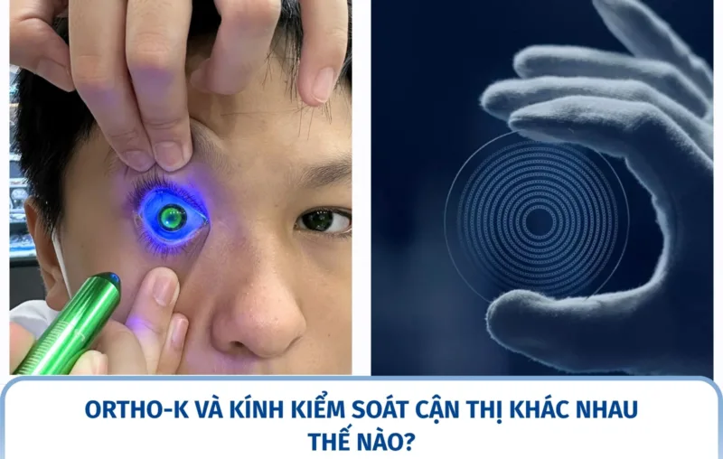 Ortho-K và kính kiểm soát cận thị khác nhau thế nào?